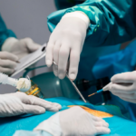 Laparoscopy